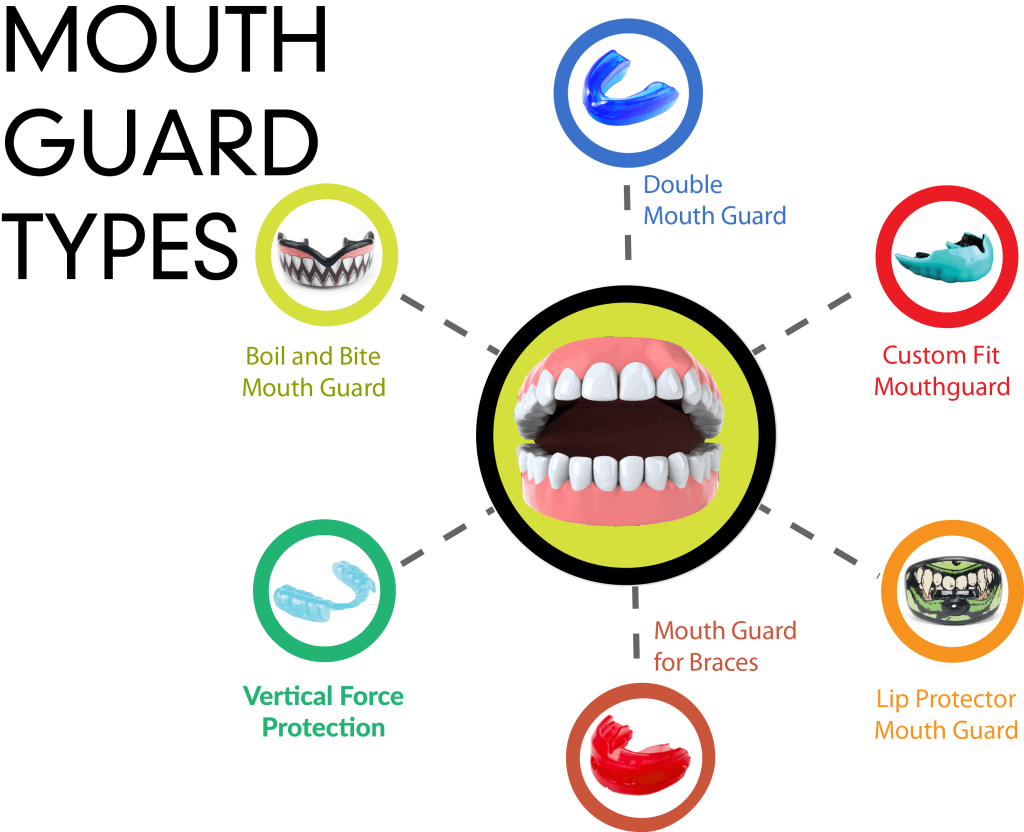 Types of Mouthguards